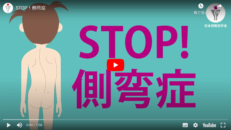 STOP 側弯症
