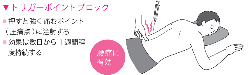 ブロック治療画像